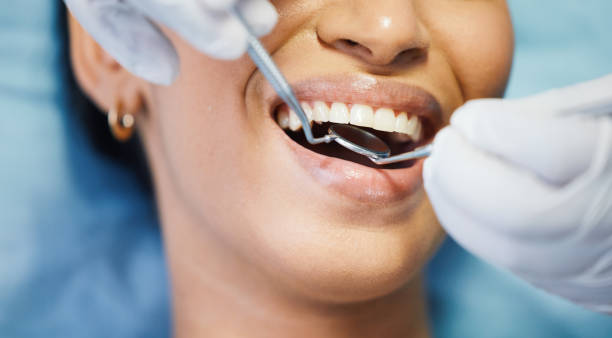 Best Emergency Tooth Extraction in Marsing, ID